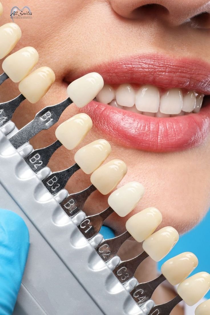 Cosmetic Dentistry In Hyderabad