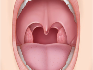 Full Mouth Rehabilitation