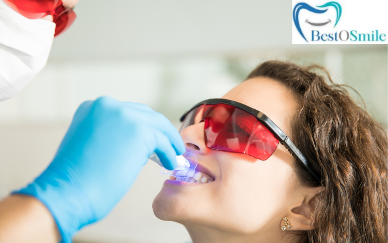 affordable teeth whitening services in hyderabad